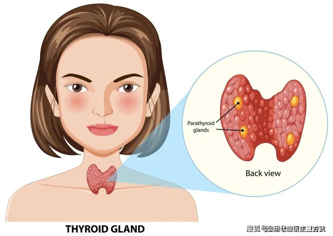 甲状腺疾病患者，应该这么吃！(图1)