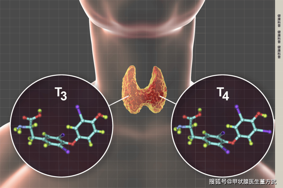 14类人易患甲状腺疾病，须格外重视！5种常见甲状腺疾病症状及预防方法(图2)