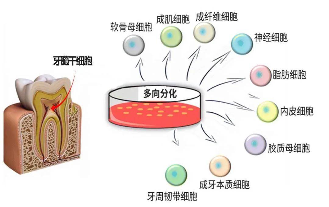 牙髓干细胞：破解“不死癌症”糖尿病治疗魔咒