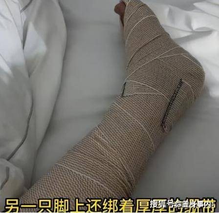 陈学冬近照曝光！35岁已一头白发，两年四次手术11部剧下架