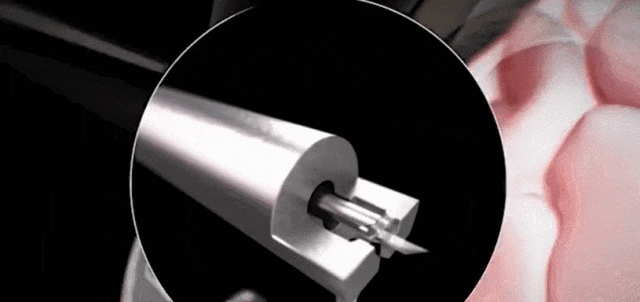 马斯克脑机接口公司重大突破，1.5秒快速植入电极，万人等待上脑