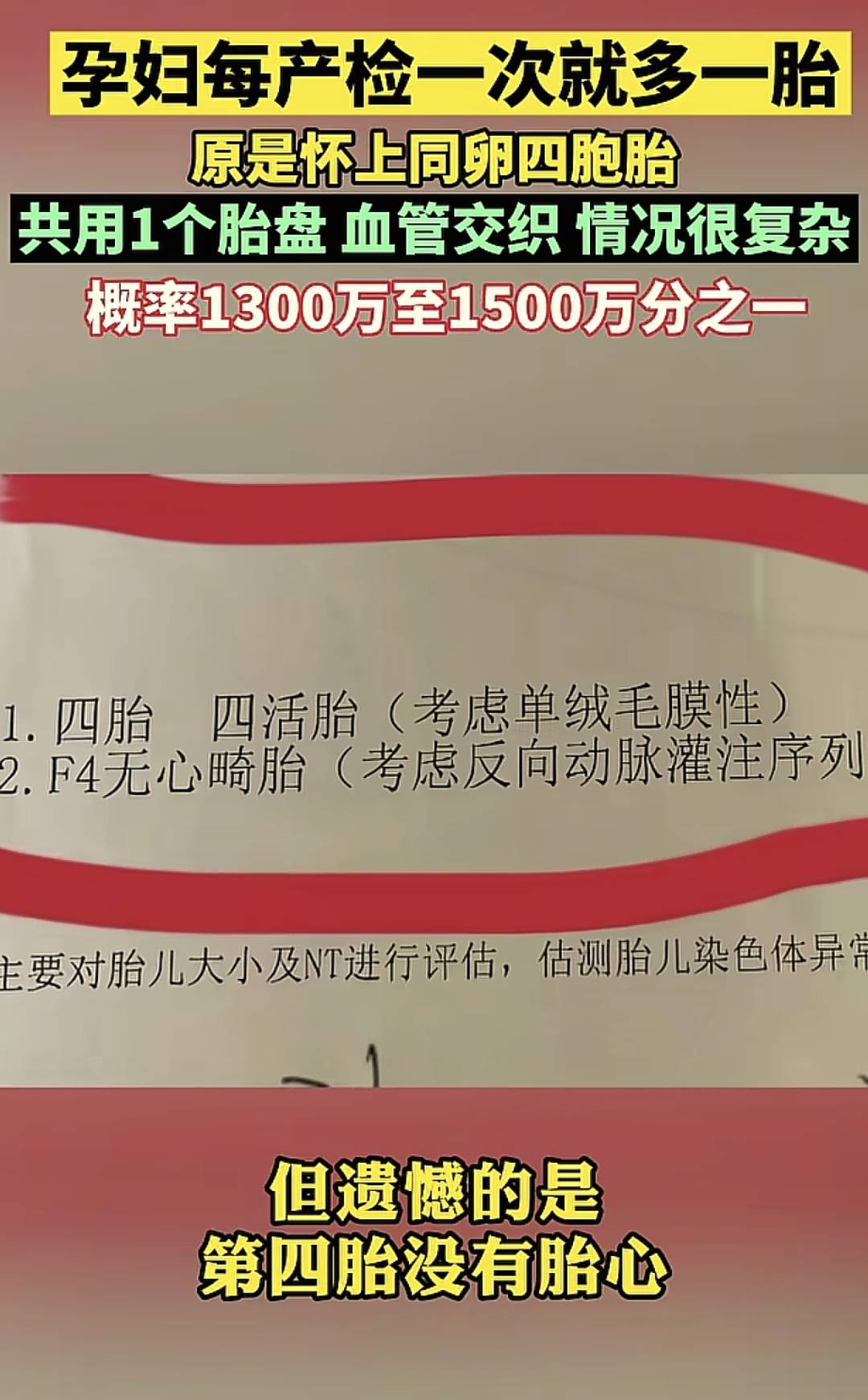 孕妇每产检一次就多一胎,原是怀上同卵四胞胎,医生摇头:要不了