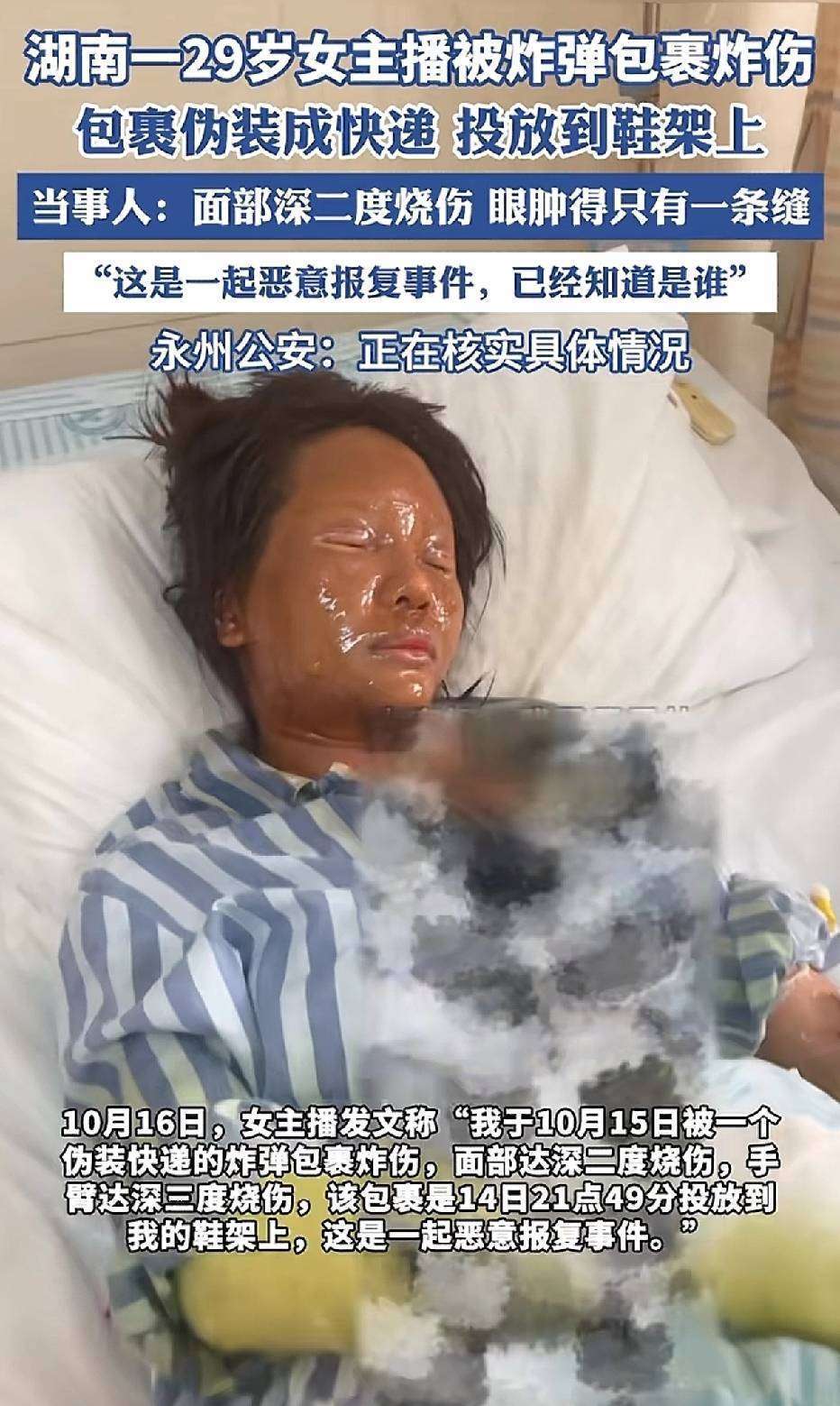 第四次才得手!快递盒藏致命陷阱女主播躲过扎胎腐蚀终被炸伤警方起底疯狂粉丝