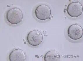 试管干货｜促排期做好这几点，卵子质量更出彩