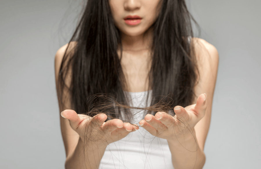 生完孩子严重脱发怎么办?如何改善?