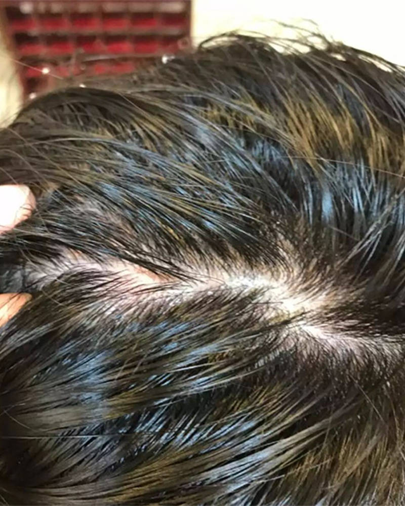 头发出油痒用什么洗发水？【多款产品评测，找到最好的】