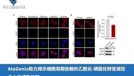 AtaGenix助力揭示细胞周期依赖的乙酰化-磷酸化转变调控中心体成熟机制