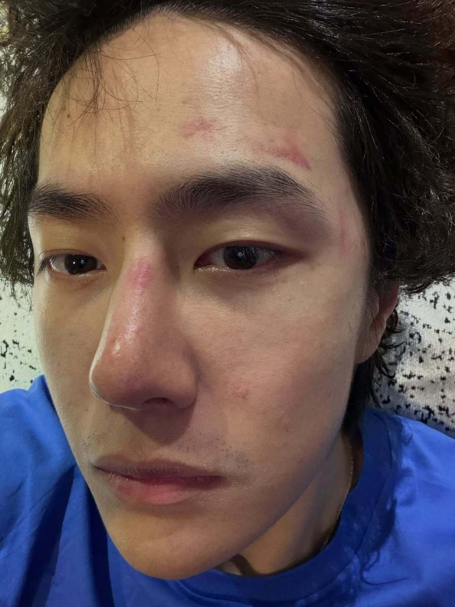 王一博INS晒自拍照 怼脸镜头下脸部泛红状态好真实