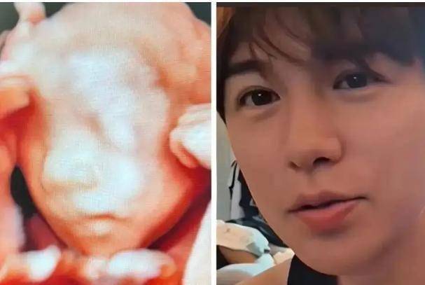 网红大北北曝虎牙直播_NBA直播_足球篮球英超欧洲杯高清体育赛事童锦程猛料：第一桶金是靠女人得来的为人好相处但好色