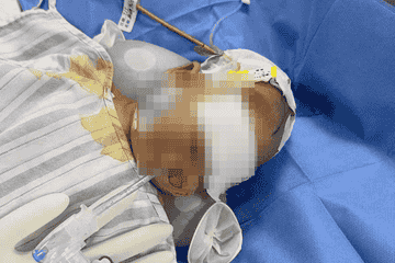 武汉2月龄女婴脑出血 家长曾质疑"月嫂照料"半年后右脑已萎缩