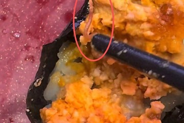 深圳寿司郎门店被曝疑似吃出寄生虫 检测报告拖