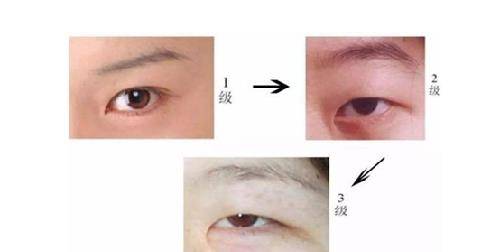 炎黄子孙身上独有的3大“印记”，倘若你都有，那就是了