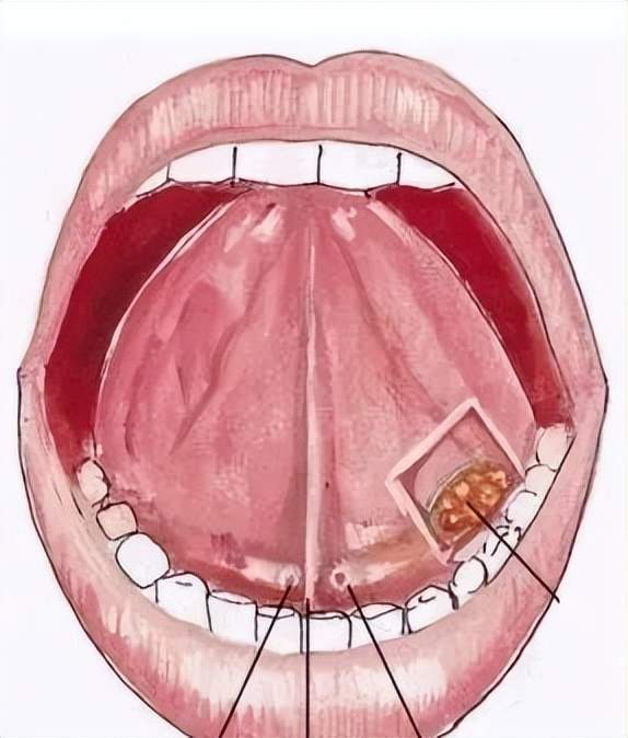 舌头构造真实示意图图片