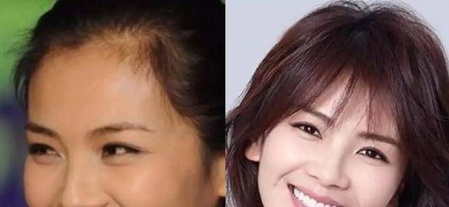 她花百万弄一口烤瓷牙,从配角变成女主角,难道这和形象有关系?