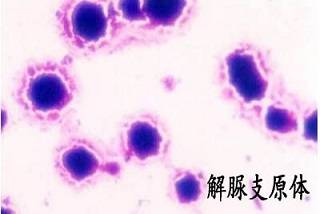 人型支原体和解脲支原体的区别