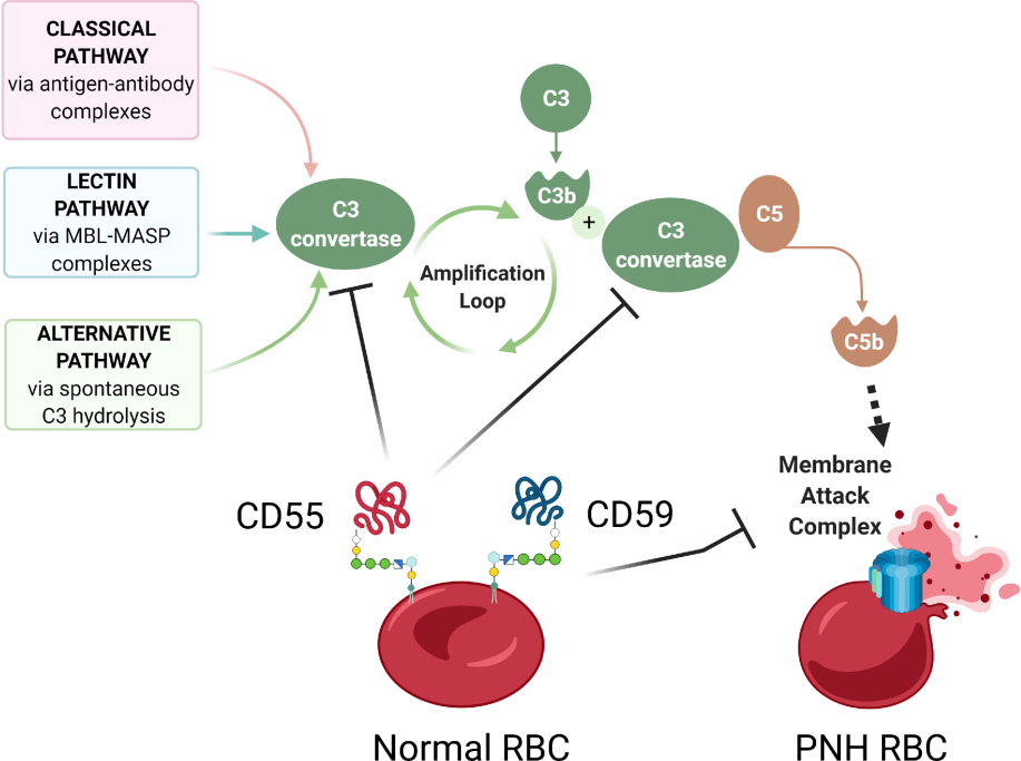 补体介导的pnh溶血:gpi锚定蛋白cd55和cd59缺乏,pnh红细胞上的补体