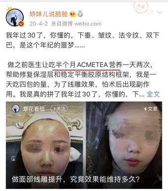 扒皮:無痕筋膜提升多少錢?無痕筋膜提升是什麼手術?_面部_組織_效果