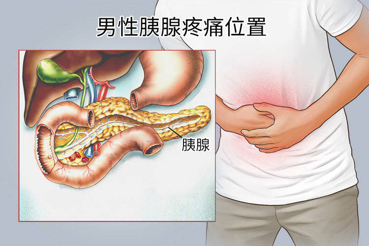 胰腺位置图片清晰图片图片