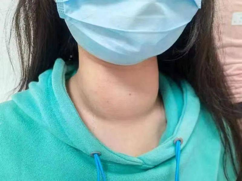 甲状腺结节如果出现这几种情况,别再犹豫,尽早处理,避免发生癌变!