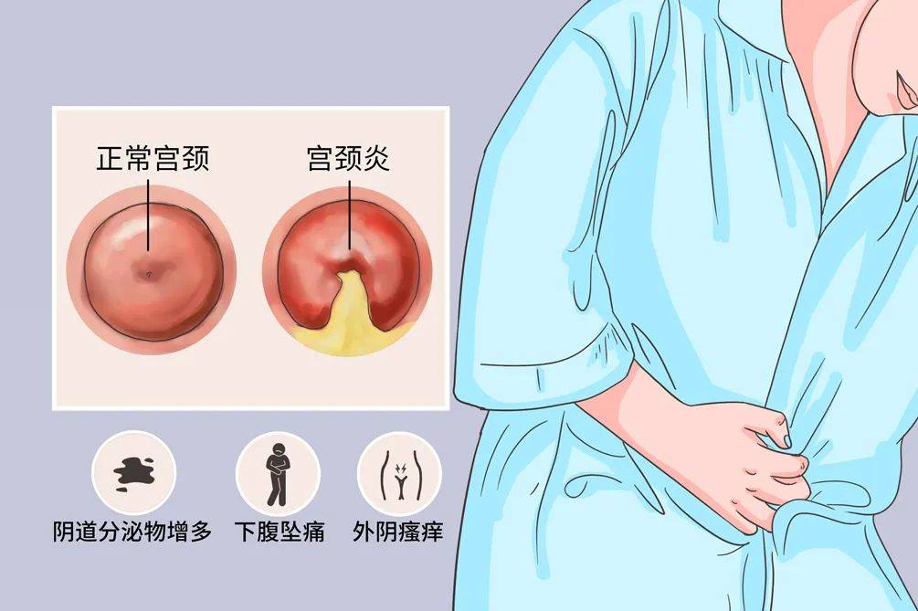 妇科病的症状图片图片