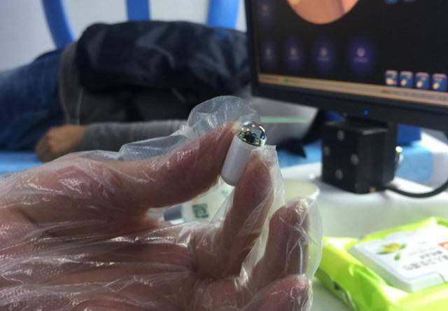 哪些人需要做胃镜?医生科普