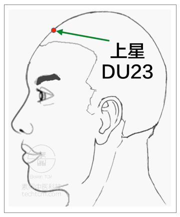 上星穴是鼻科的大穴.用米粒灸.