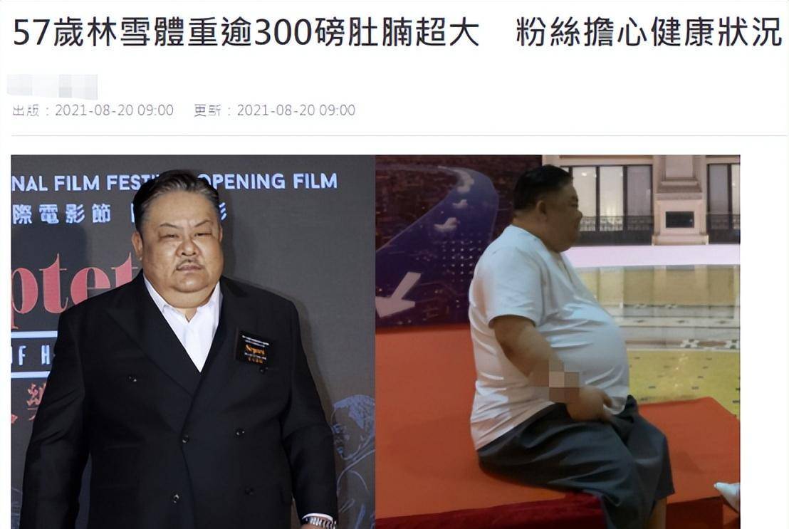 58岁林雪近照脸上现黑斑,体重超270斤,满身肥肉肚大如球引担忧_身体