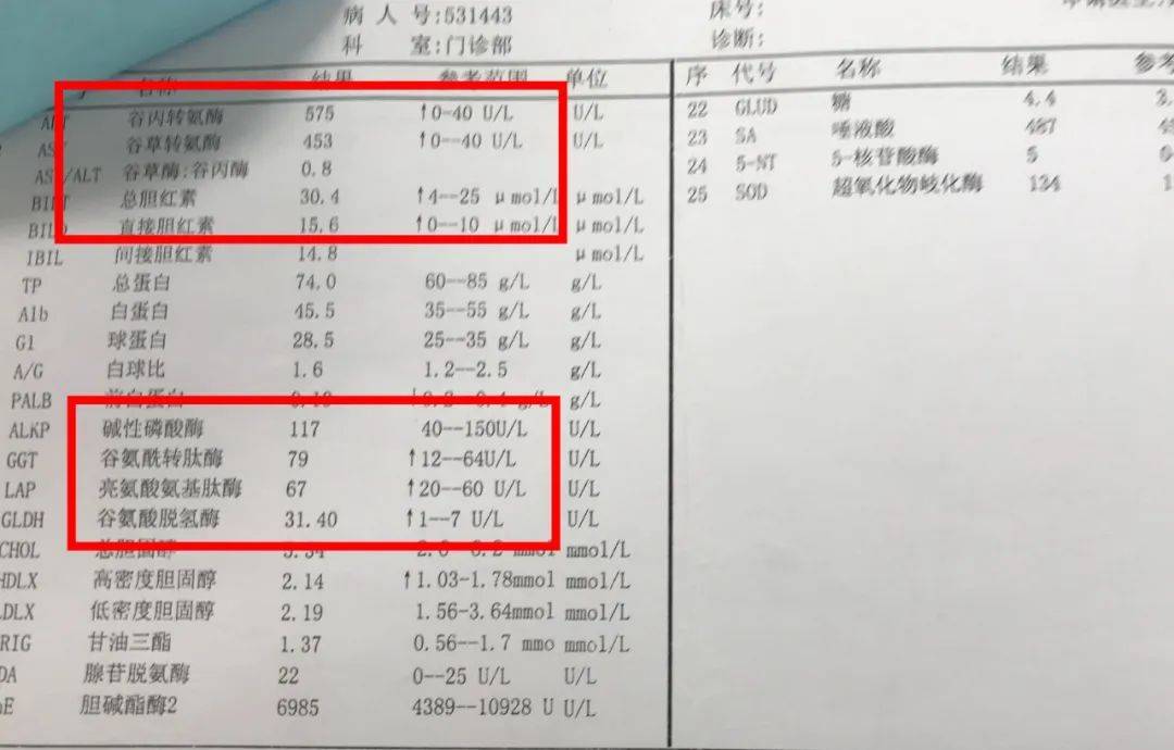 肝硬化b超报告单图片