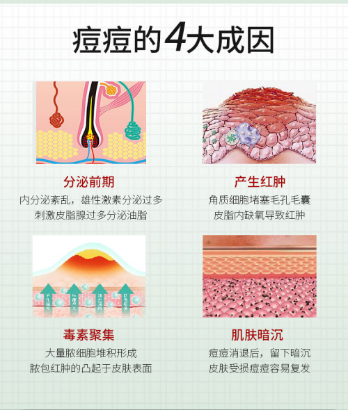 此外,初原漾淨痘啫喱還能完美解決亞洲痘痘肌膚的四大成因問題,直擊