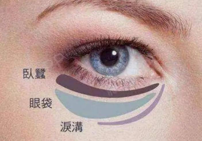 做眼袋手术有没有后遗症?