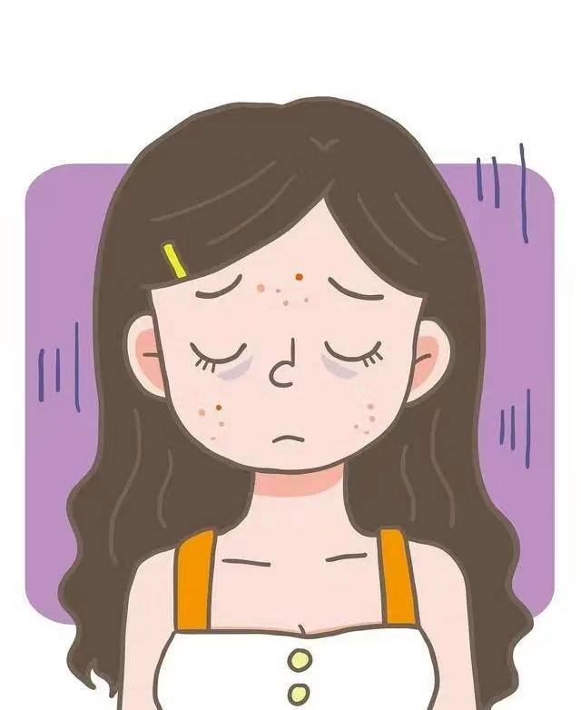 长痘可以吃什么水果_长痘痘_皮肤_维生素