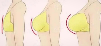 业内人士说说:脂肪丰胸有什么危害和后遗症吗?_细胞