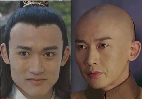 中老年男星整容后遗症显现,表情都做不出来,演技也略