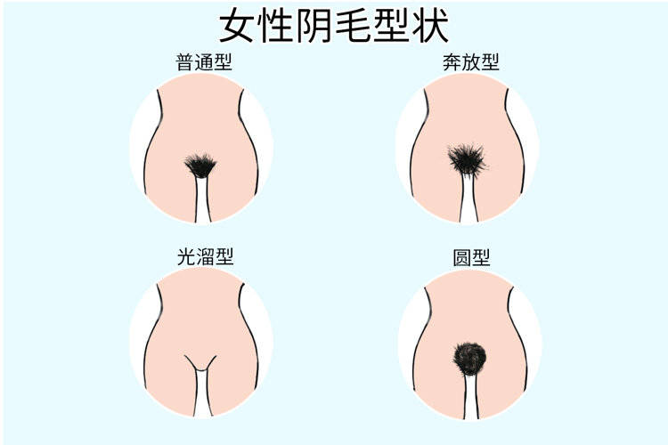 女性不长阴毛主要与雄激素水平较低,阴部毛囊缺少雌激素受体或受体对