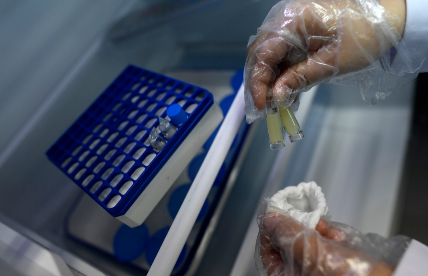 精子存活率检测麻烦吗?_生育_男性_样本