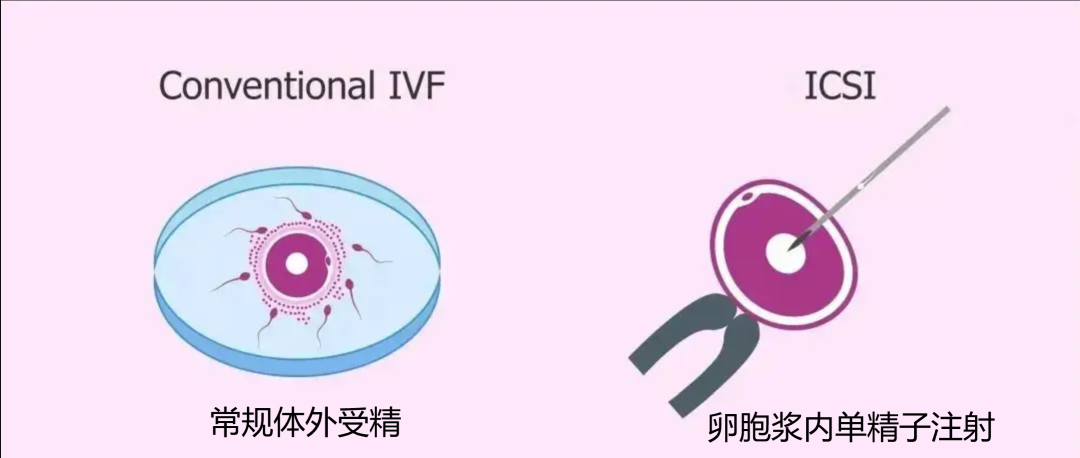 北大乔杰,浙大黄荷凤两大院士联手发lancet文章:辅助