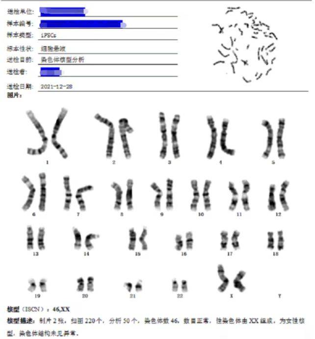 女性正常染色体报告单图片