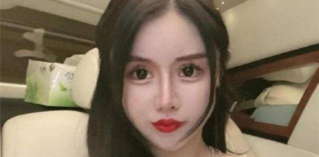 3年整了60次的网红女孩,现状如何?_整形_娜娜_生活