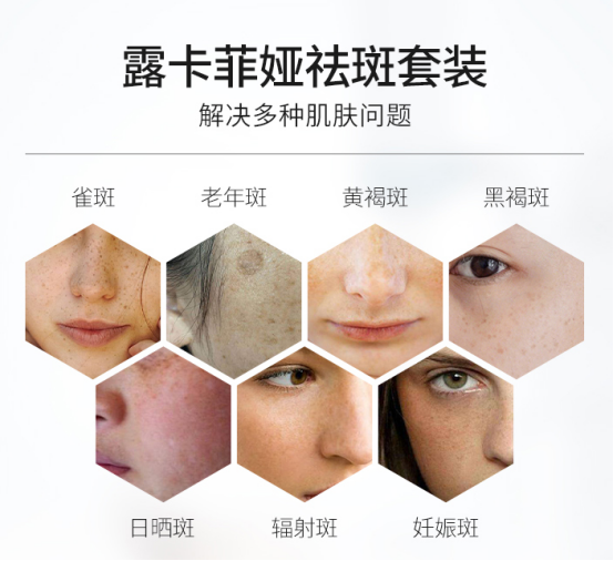哪个牌子的祛斑霜效果最好?零失误率的几款介绍_成分_肌肤_质地