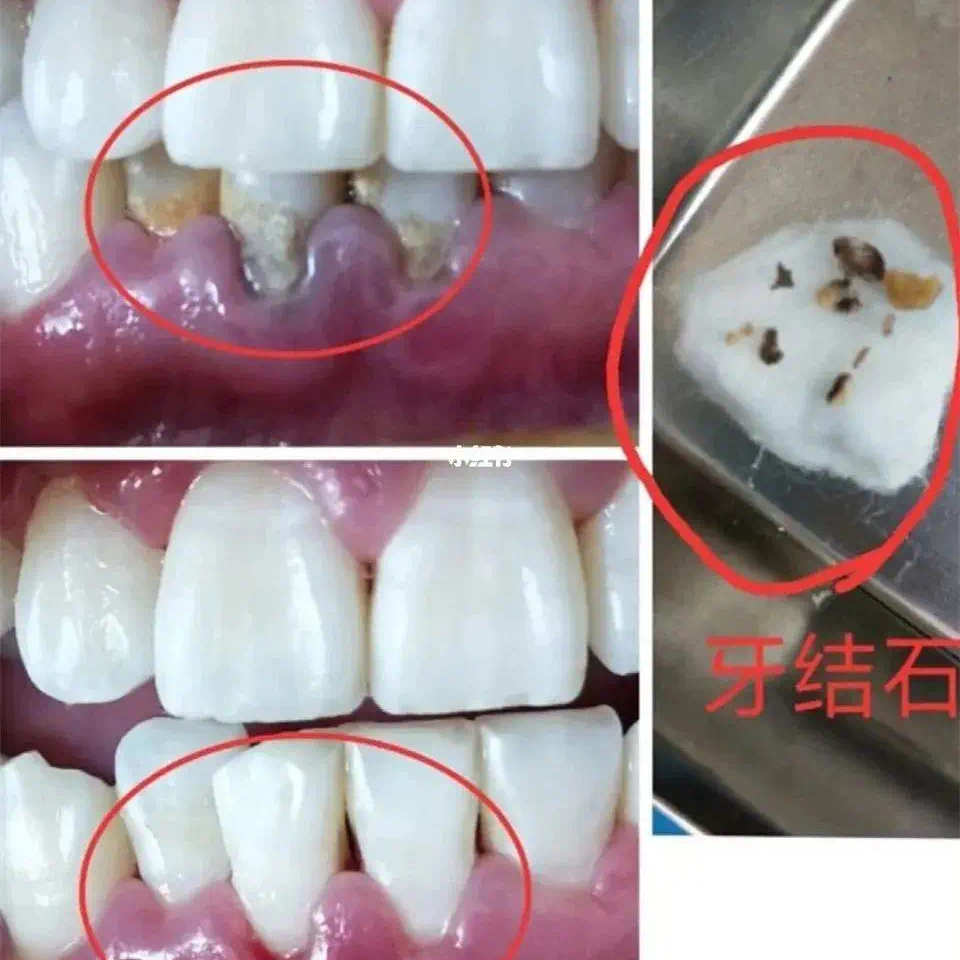 抓紧了解!_牙齿_白色_经验