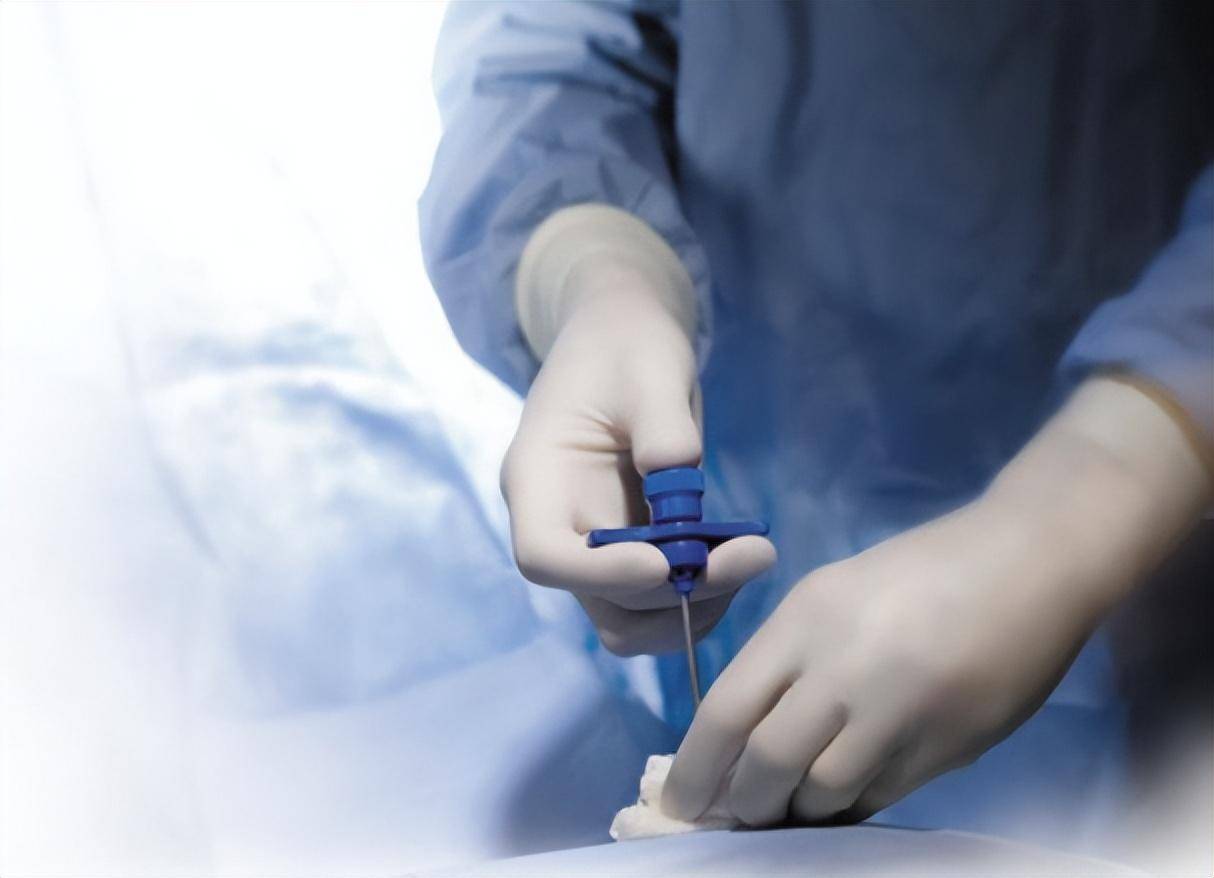 关于穿刺活检,你想知道的都在这里_诊断_进行_病理科