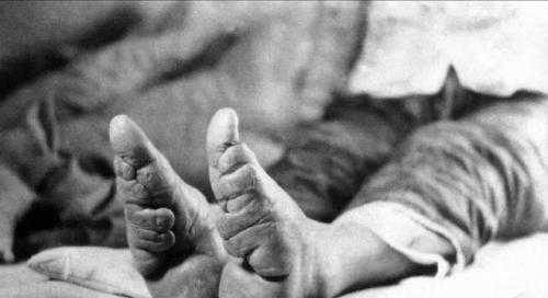 而古代妇女的裹脚,就是为了迎合男人的对于"三寸金莲"的畸形审美而