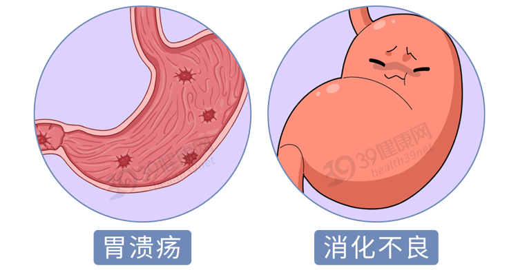 提醒:放屁多和臭,或与4个原因有关_食物_肠道_饮食