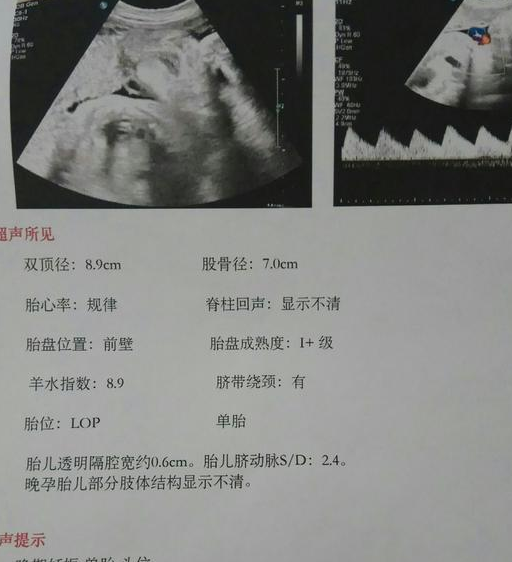 胎儿36周发育标准数值图片