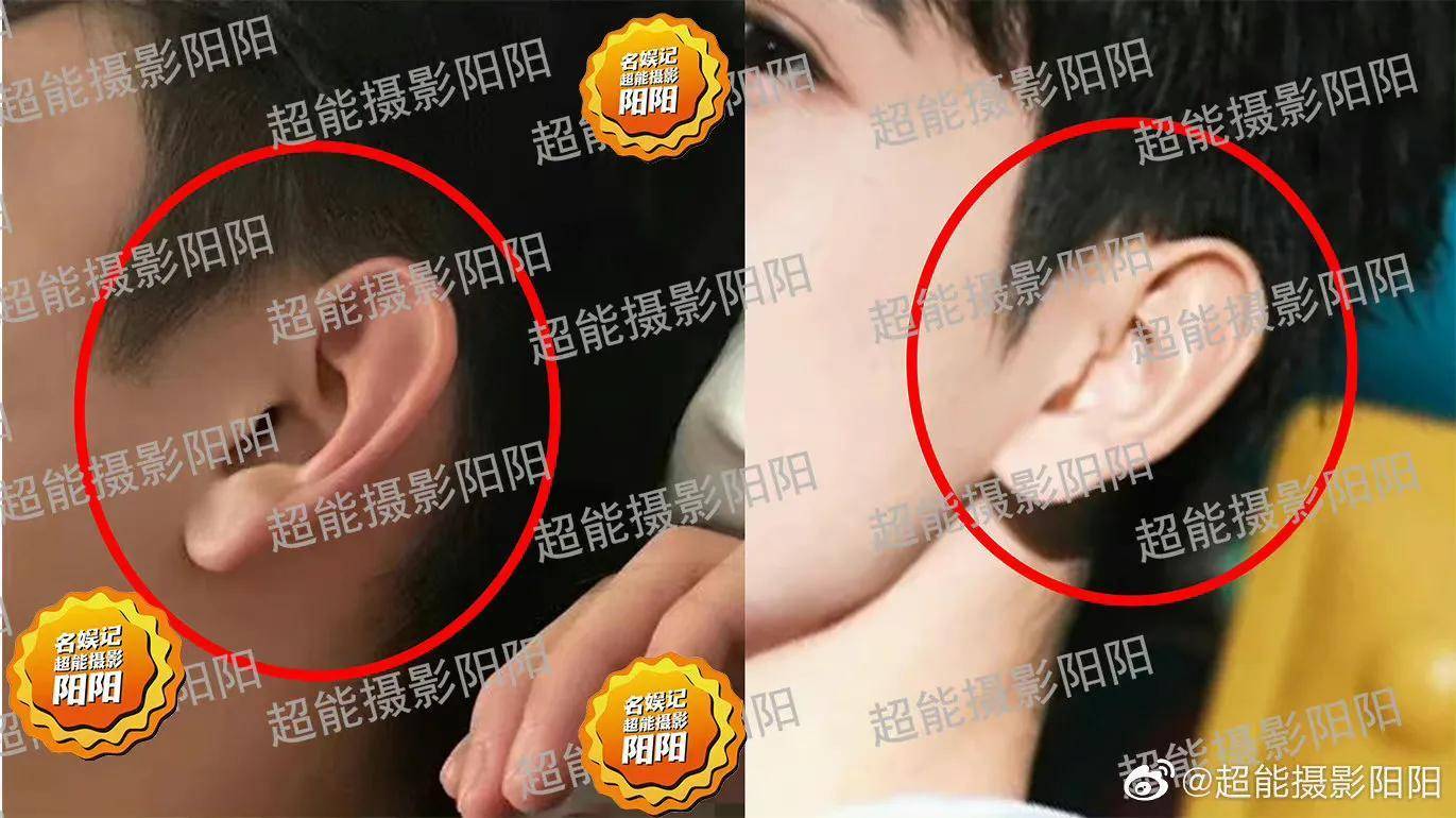 经过阳阳以及网友的对比,发现近照中男生的耳朵,嘴角