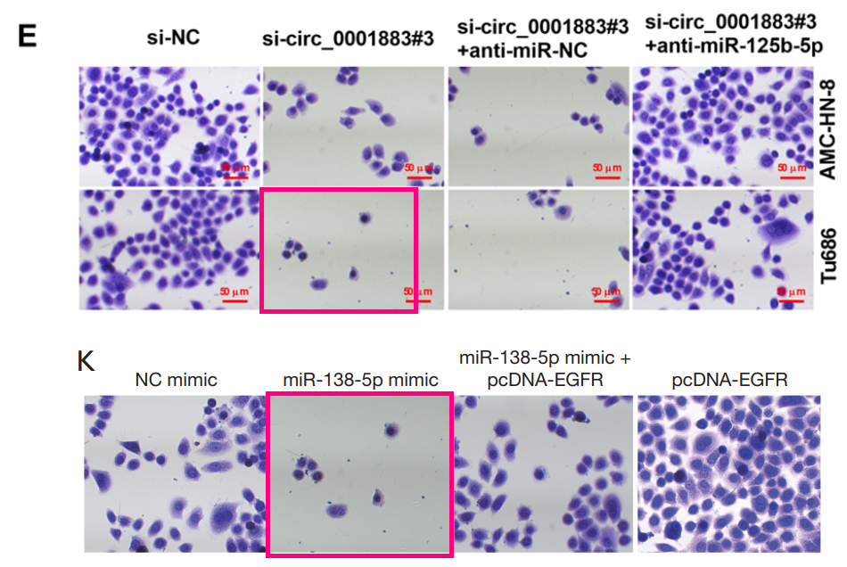 复旦大学附属眼耳鼻喉科医院王胜资等人和上海第九人民医院合作的论文