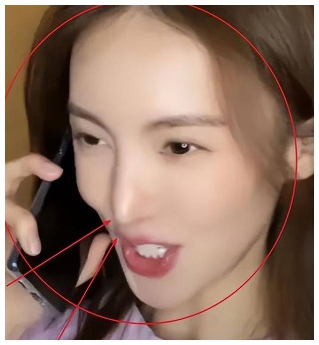 大饼脸变锥子脸,明星不认整容?基因出卖,无法否认.