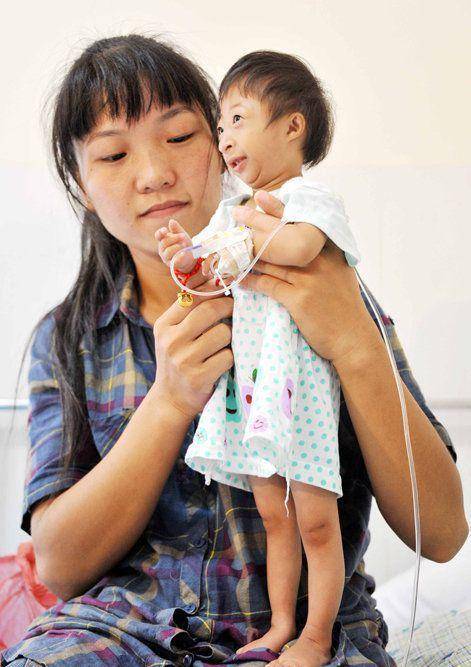 湖南"猴孩":出生时仅有2斤一两,4年长21cm,马戏