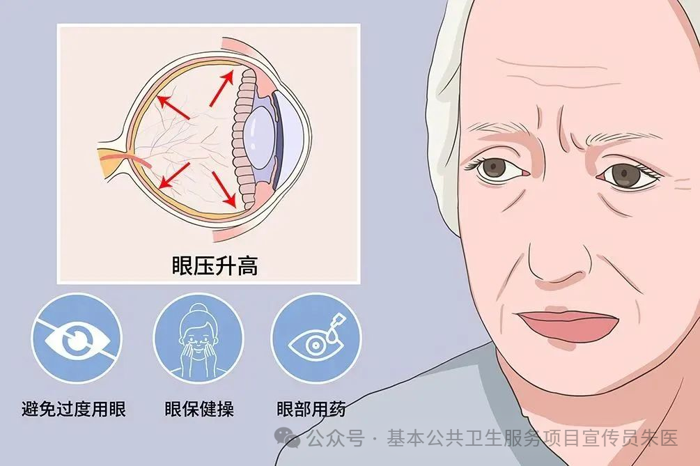 世界青光眼日共管慢病青光眼留得光明恒久远