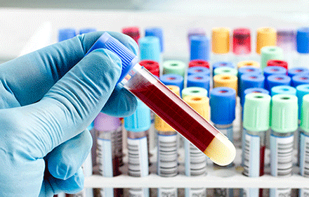 原创准妈妈如何顺利通过糖筛检查6个小经验帮你轻松通过没负担